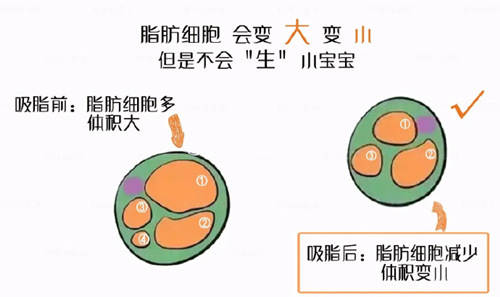 成年人体内的脂肪细胞数量是固定的